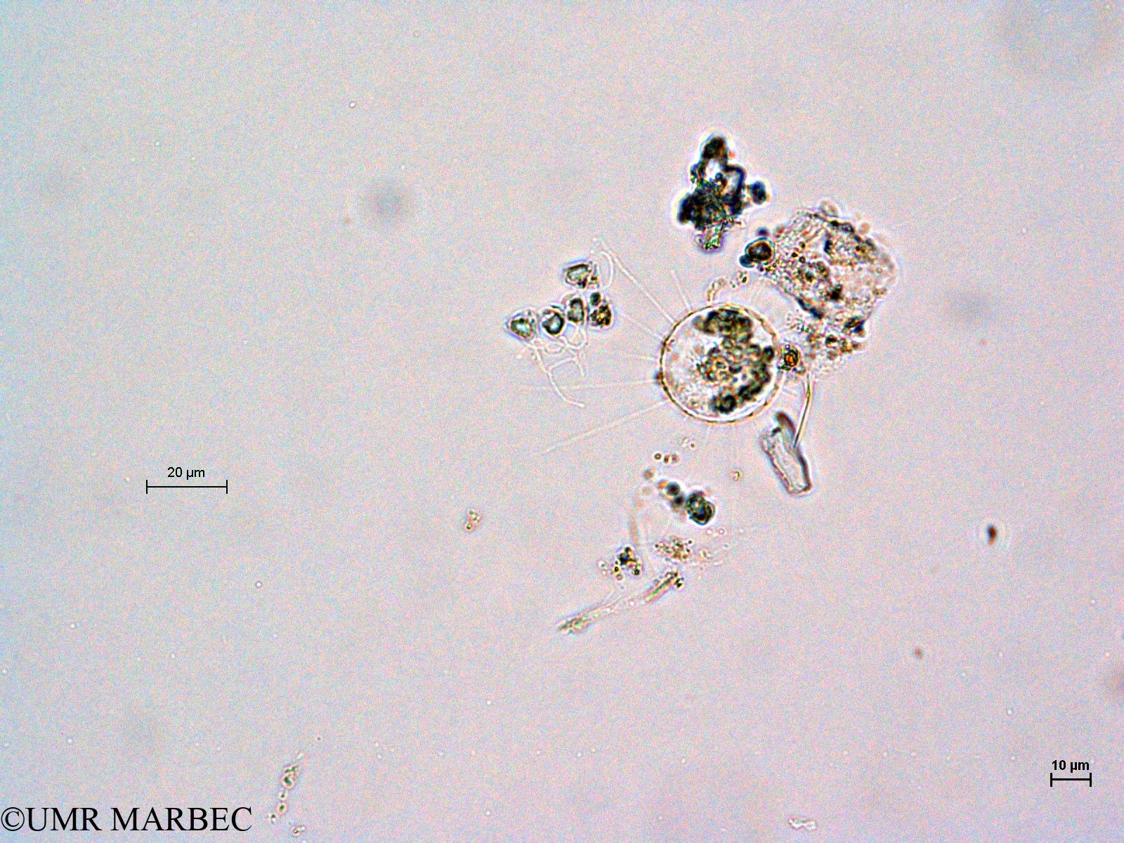 phyto/Thau_Lagoon/THAU_station1/GELAMED 2010/Asterionellopsis glacialis et Bacteriastrum sp1(copy).jpg